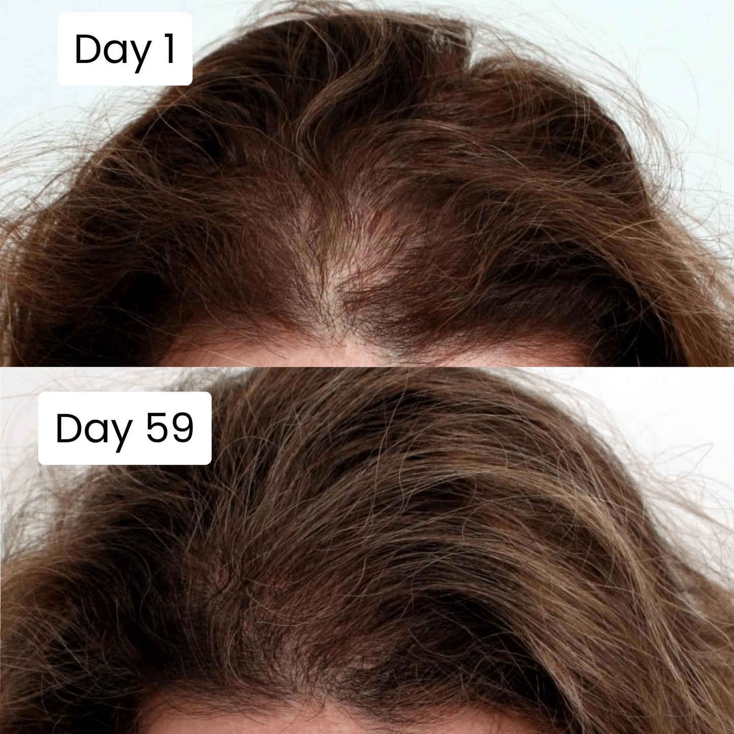 Scalpy Hair Growth Serum Original Limited Time Deal With Free Home Delivery All Over Uae
